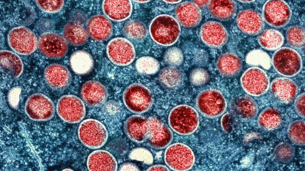 Genetic data indicate at least two monkeypox outbreaks underway