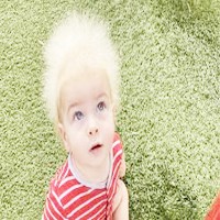 Uncombable Hair Syndrome in Black Hair - Thoughtful Blog